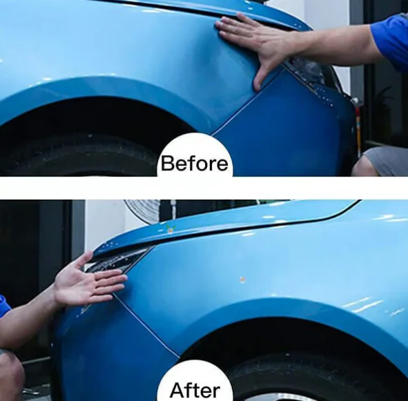 🚗Car Body Dents-Remover Puller Cups🔥 - Image 3