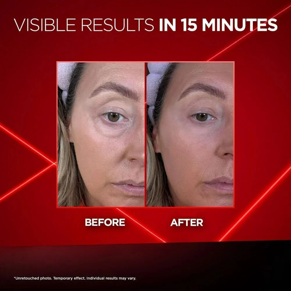 🔥Last Day 49% OFF💥Eye Bag Instant Eraser, Tightens, Firms, & Blurs Wrinkles - Image 6
