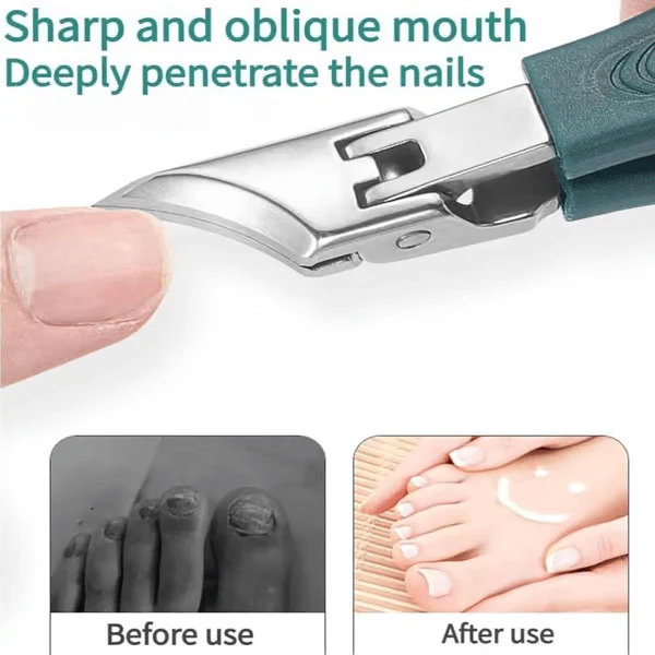 💥Buy 1 Get 1 Free🔥Eagle Beak Angled Nail Clippers 3-Piece Set