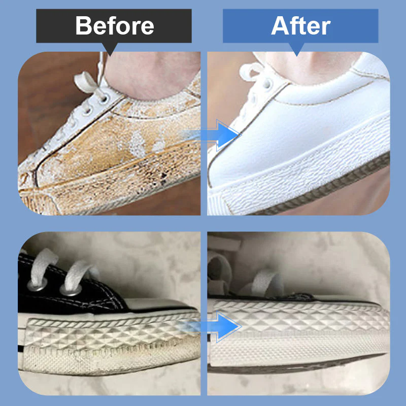 🔥Last Day Sale: £7.99!🎁50K+ SOLD! Almost Gone✨Portable Shoe Stain Remover Kit - Image 5