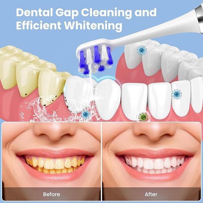 🎅BLACK FRIDAY SALE 50% OFF!!!🎄Rechargable Plaque/Tartar Remover Oral Care Kit ✨ - Image 6